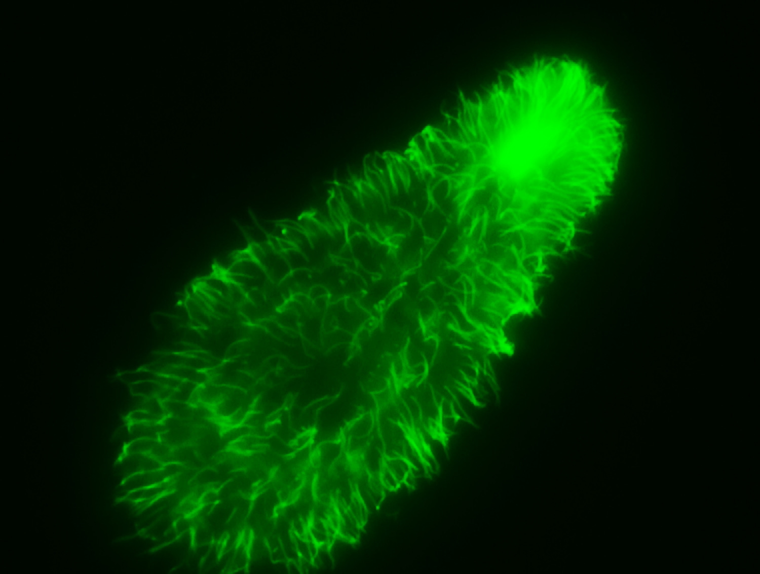 Actin-stained Tetrahymena